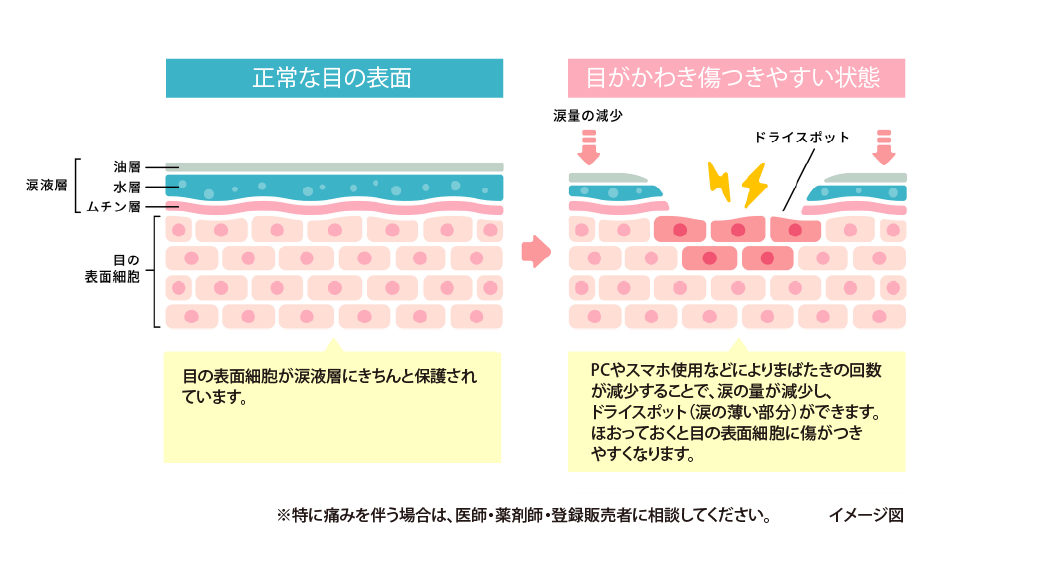 目の渇きが原因